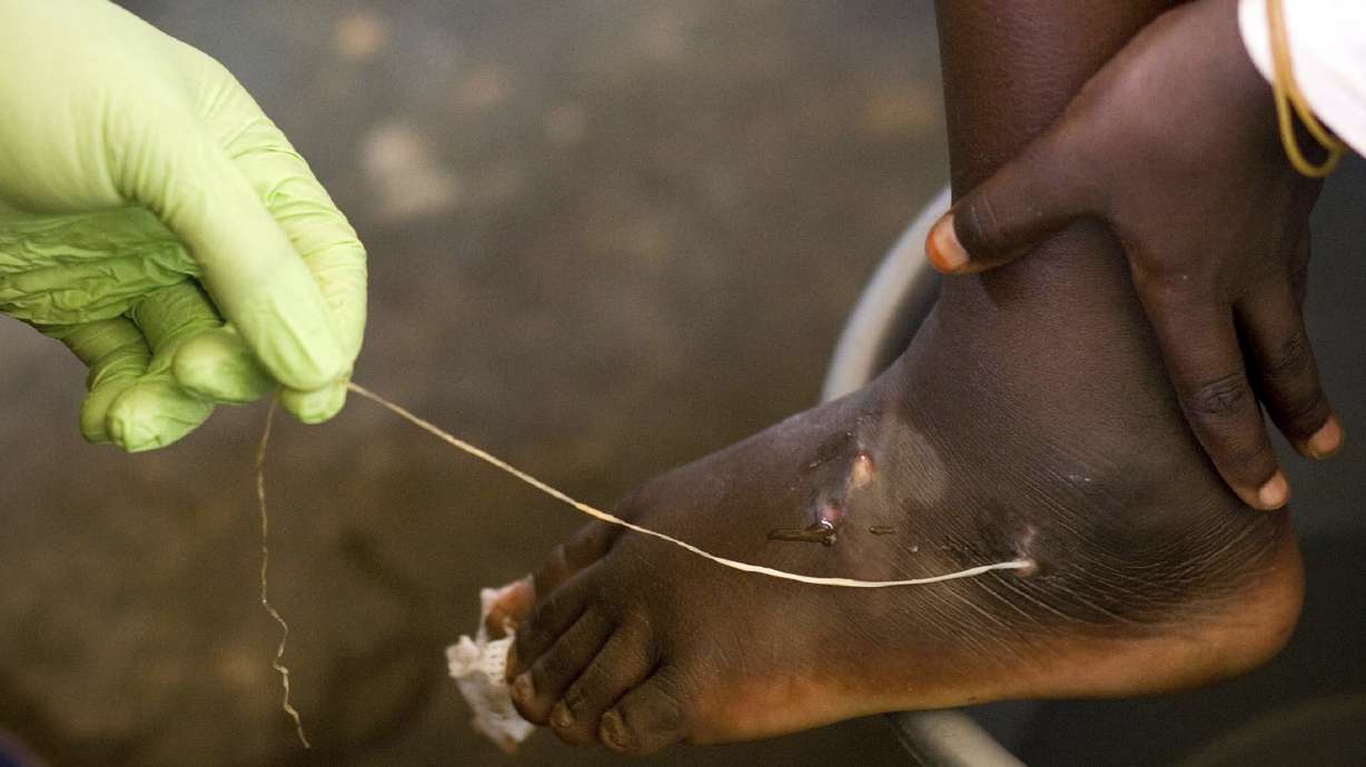 Guinea worm closer to eradication as cases halve in a year