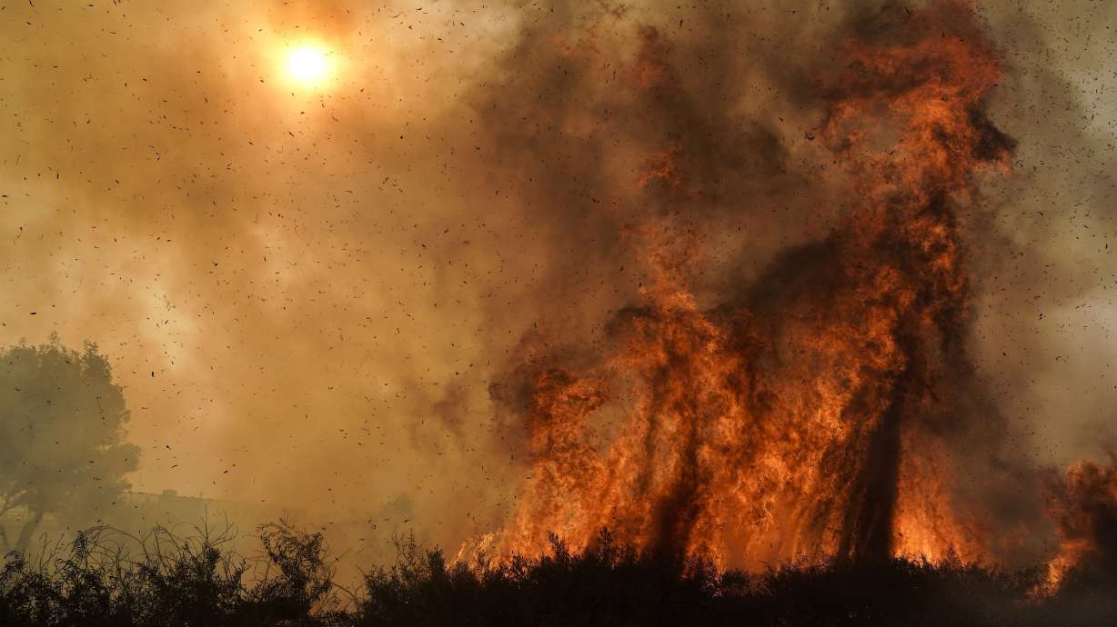 Burned firefighter leaves California hospital to cheers