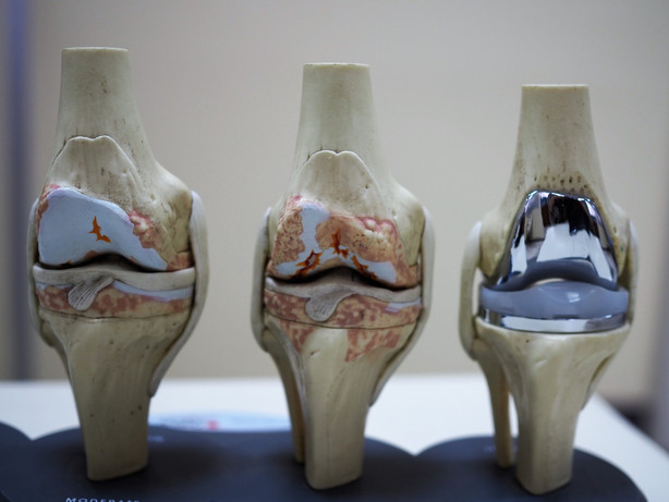 Knee pain? Robotic joint replacement system promises less pain, quicker recovery