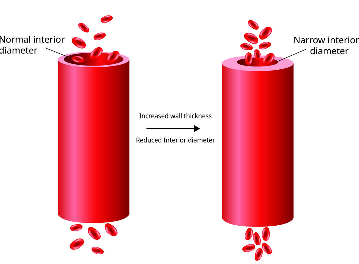 New discoveries reveal the real causes and solutions for ED