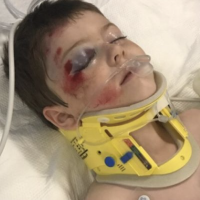 Utah parents issue warning after 5-year-old falls from second-story window