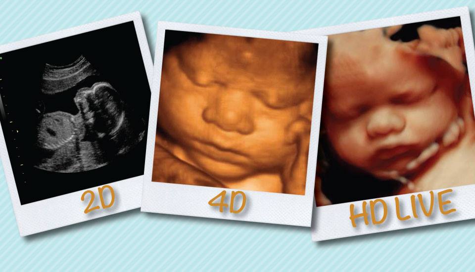 Get to know your baby before they're born with early image scans and gender blood tests