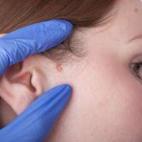 10 things you can do to prevent skin cancer this summer