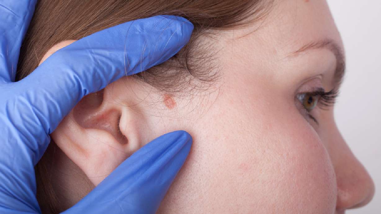 10 things you can do to prevent skin cancer this summer