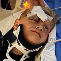 Utah boy recovering from brain injury caused by falling on pencil