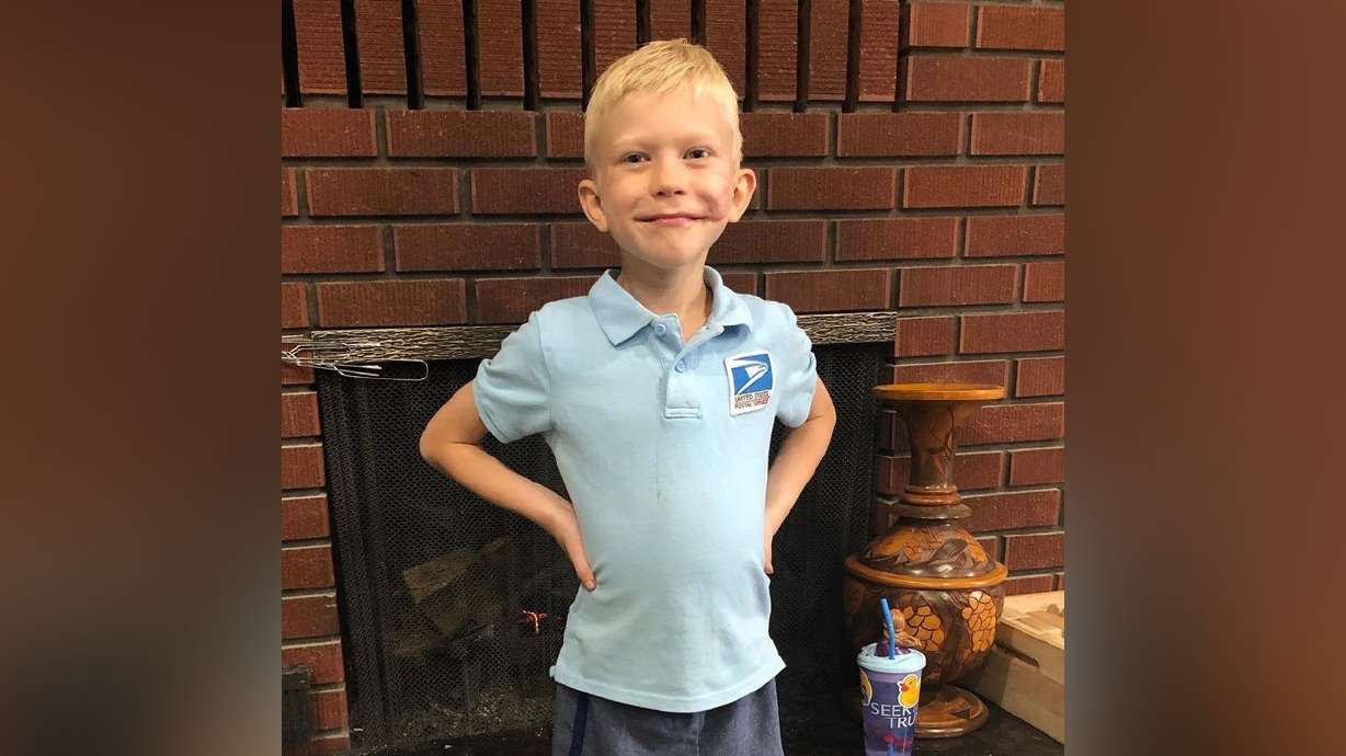 Bridger poses for a picture in February 2021 one month before final laser treatment.