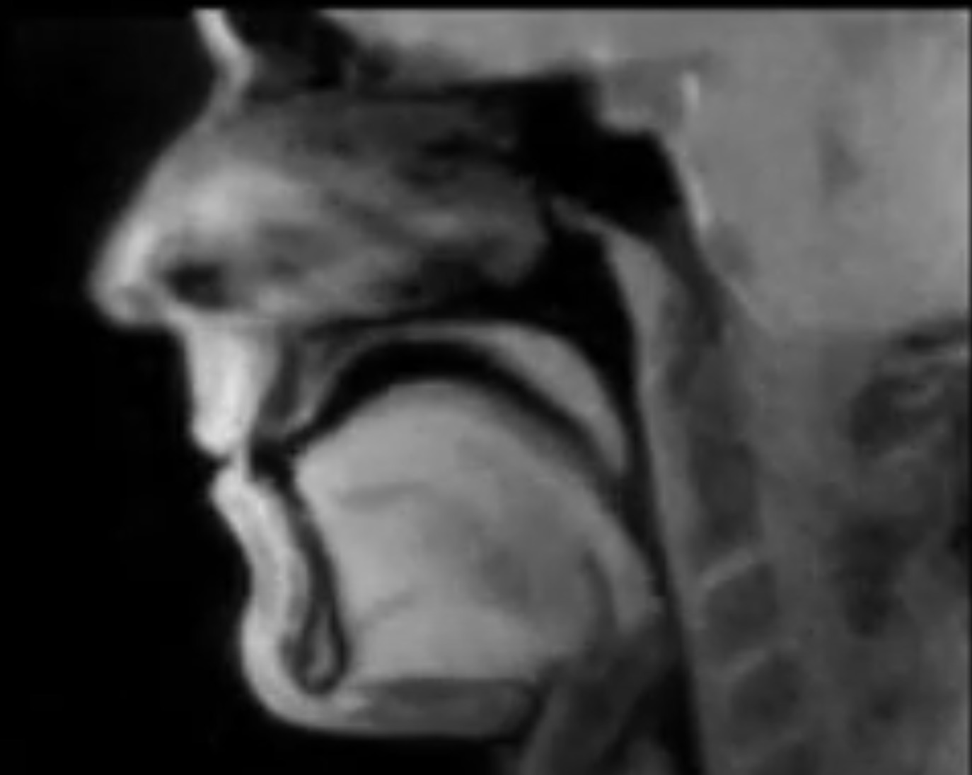 Have You Seen This? No longer wonder what a beatboxer's mouth looks like in a real-time MRI