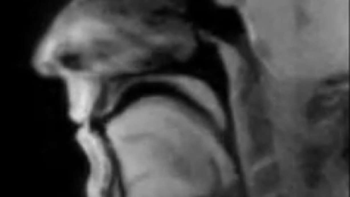 Have You Seen This? No longer wonder what a beatboxer's mouth looks like in a real-time MRI