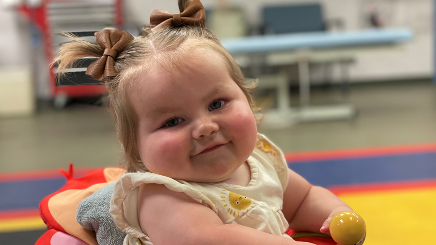 Claira Stanger, age 1, has an orthopedic condition that prevents her from reaching early milestones like crawling and walking.