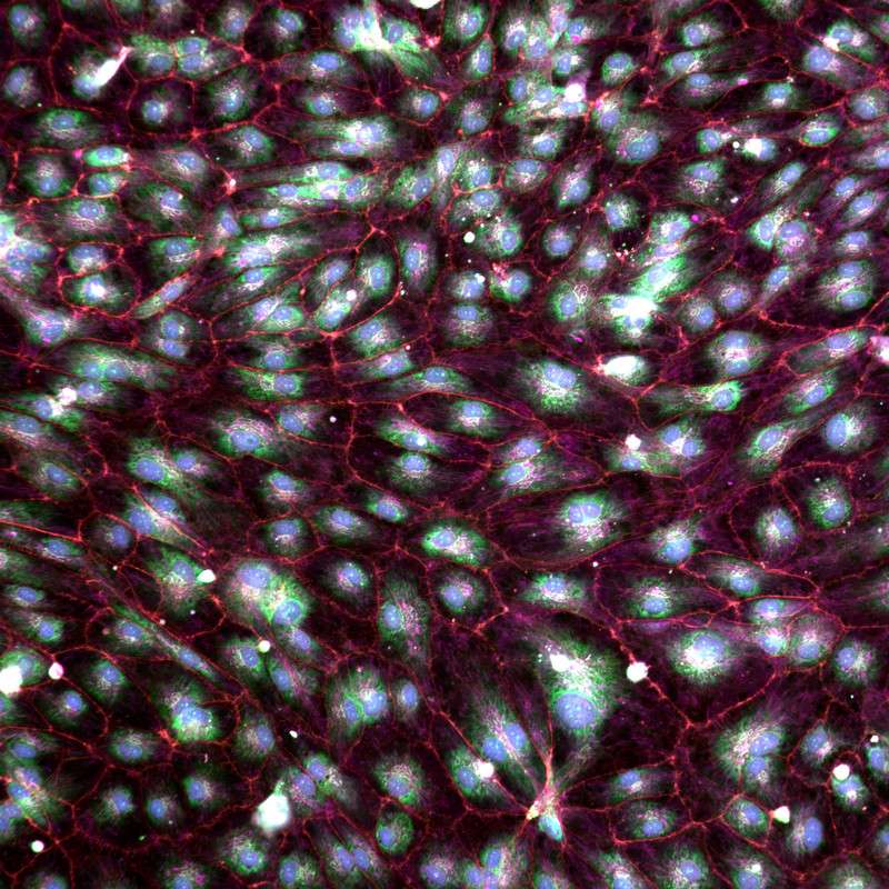 A cellular experiment image from Recursion Pharmaceuticals. The company just announced plans to double its 100,000 square foot headquarters in downtown Salt Lake
City.