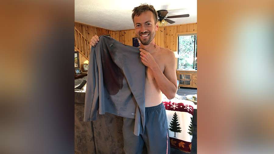 Tom Whitney holds up the shirt he wore when attacked by a grizzly bear in Island Park, Idaho, Friday, July 9, 2021.