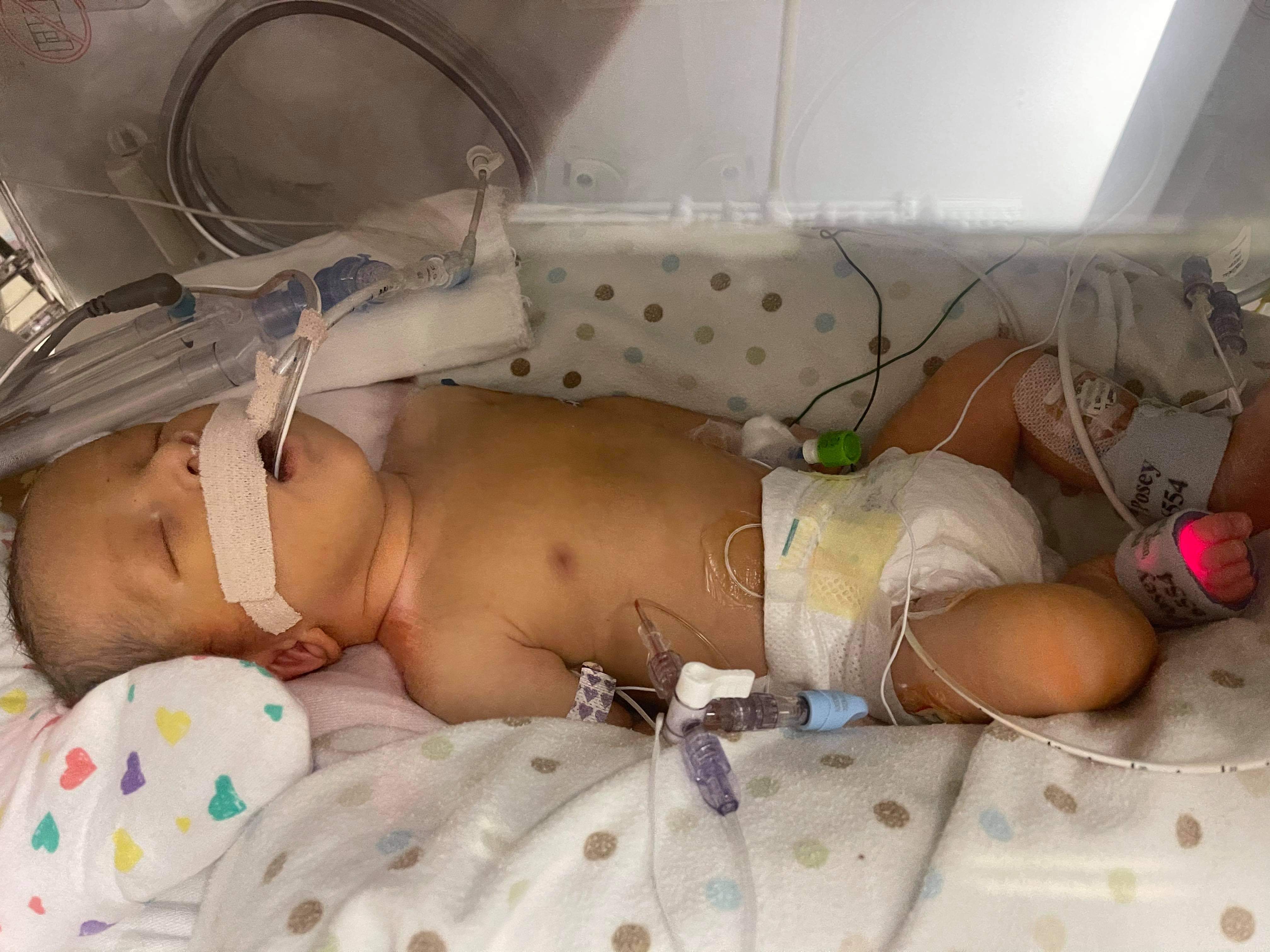 Newborn Krew Weick in the neonatal intensive care unit at Primary Children's Hospital in February 2021. Krew was born with a congenital diaphragmatic hernia, a condition that affected the development of his internal organs. He received donor breast milk during his 47 days in the hospital.