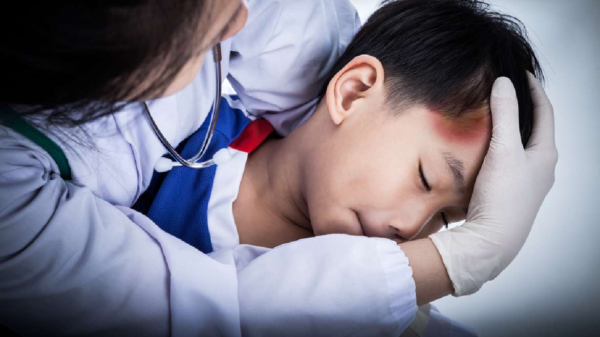 4 things to know about a new system for evaluating concussions