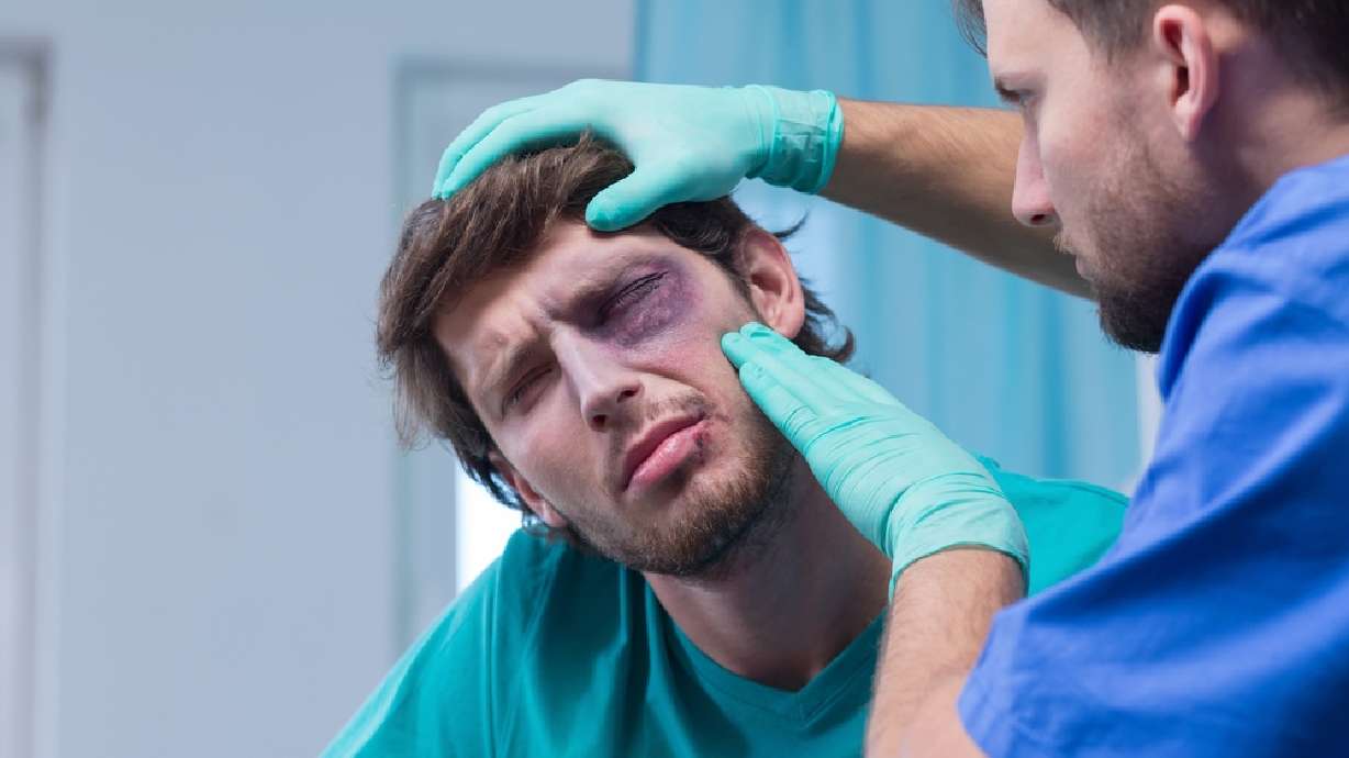 Utah man forced to seek legal help after losing an eye at work