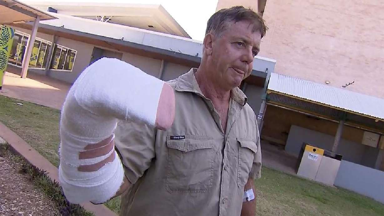 Australian wildlife tour operator Sean Dearly is interviewed in Darwin, Australia Tuesday. Dearly said he was lucky to escape more serious injury or even death when a crocodile lunged from a river and clamped his hand in its jaws.