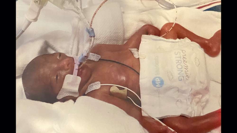 Angelica Alvarez Rojo was 24 weeks gestation and weighed 1 pound, 6 ounces, when she was born April 4.
