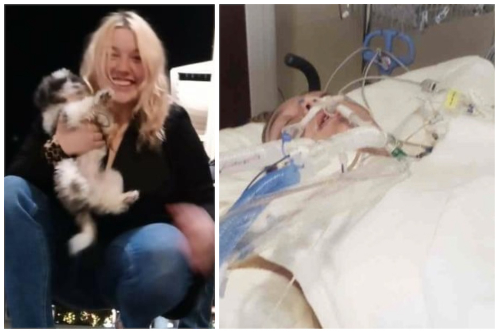 Laiha Slayton before being burned at Yellowstone National Park, left; and being treated at Eastern Idaho Regional Medical Center in Idaho Falls. Slayton was severely burned at Yellowstone National Park. Her family is asking for help and prayers following the horrific accident Monday afternoon.