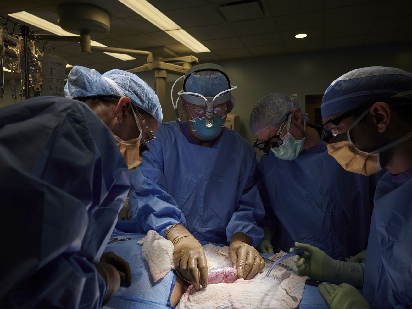 Drs. Zoe A. Stewart-Lewis, left, Robert A. Montgomery, Bonnie E. Lonze and Jeffrey Stern examine a pig kidney attached to the body of a deceased recipient for any signs of rejection in September 2021 at NYU Langone Health. The test was a step in the decadeslong quest to one day use animal organs for life-saving transplants.
