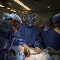 What role Utah Nobel Prize winner Mario Capecchi played in pioneering surgery to attach pig kidney in human