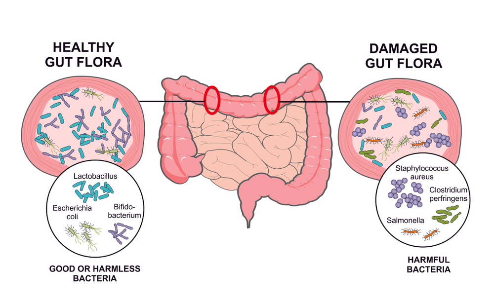 Gained weight after antibiotics? Do these 4 things | KSL.com