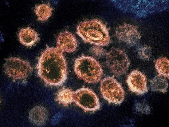 Electron microscope image shows SARS-CoV-2 virus particles, which cause
COVID-19. Pfizer announced Friday it will soon ask the U.S. Food and
Drug Administration and international regulators to authorize its pill, which is taken twice a day for five days.