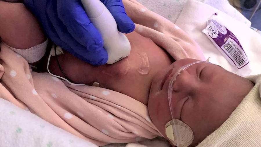 Amaya was born with a rare heart condition, which, fortunately, was found before she was born.