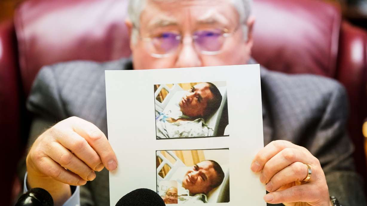 Lawyer Robert B. Sykes shows a recent photograph of Atonio Sivatia, taken in the hospital, during a press conference in Salt Lake City on Tuesday. Sivatia suffered permanent debilitating injuries when he was run over by a car while being arrested by West Valley police. He is now suing the officers involved.