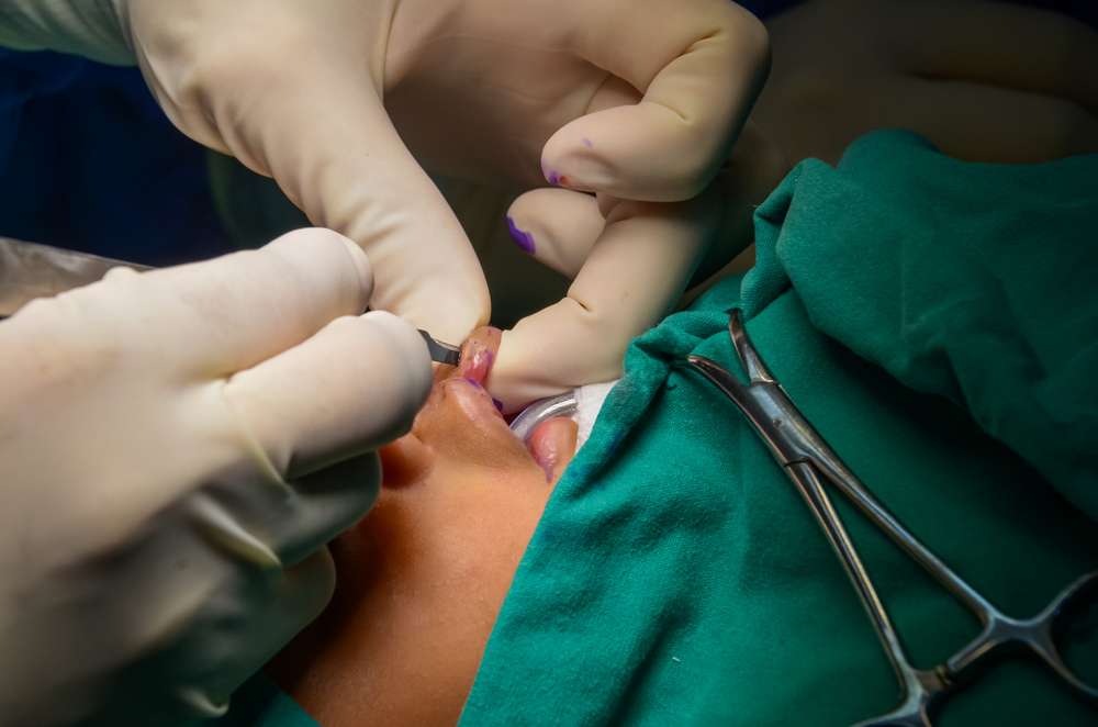 It takes a great medical team to navigate the cleft journey