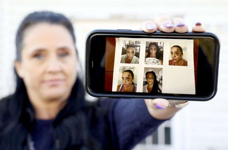 Jennette Pearson, who was assaulted while working as an
RN at the Utah State Hospital, shows photos of her after the
assault, outside of her home in Orem on Monday, Jan. 31, 2022.
Pearson is still recovering months later. HB32 would create
enhanced penalties for assaults against health care
workers.