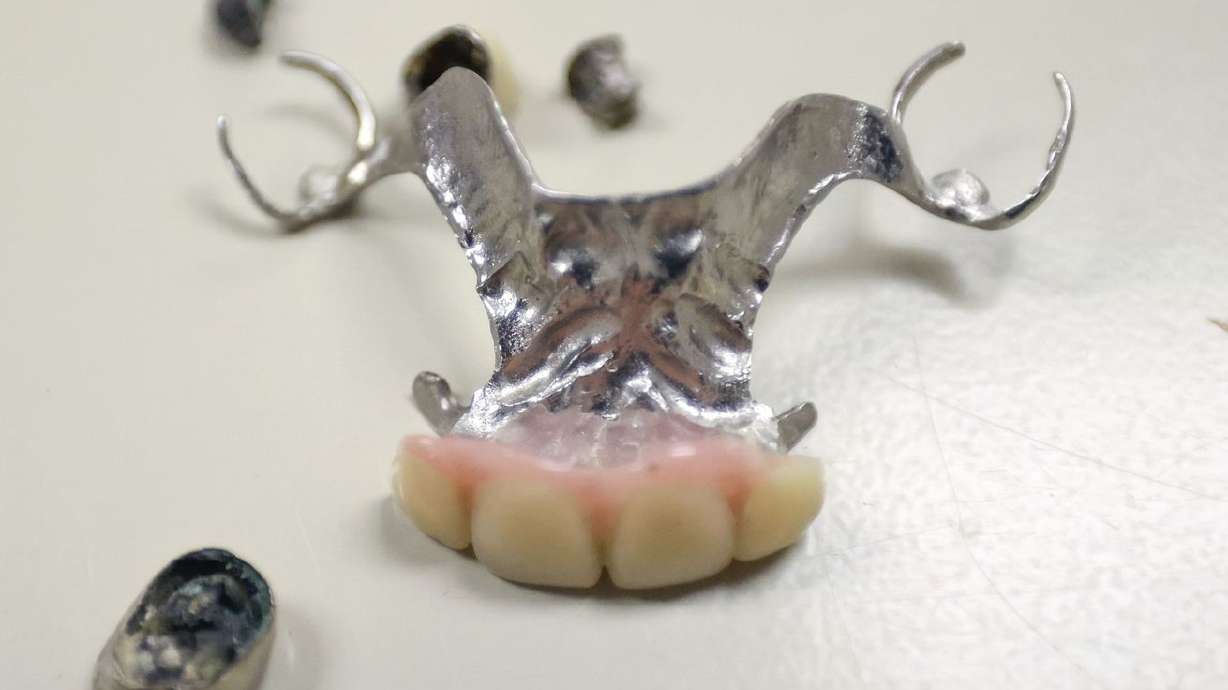 Silver teeth and a dental appliance are part of unclaimed properties pictured at the Utah Unclaimed Property Division office in Salt Lake City on Thursday.