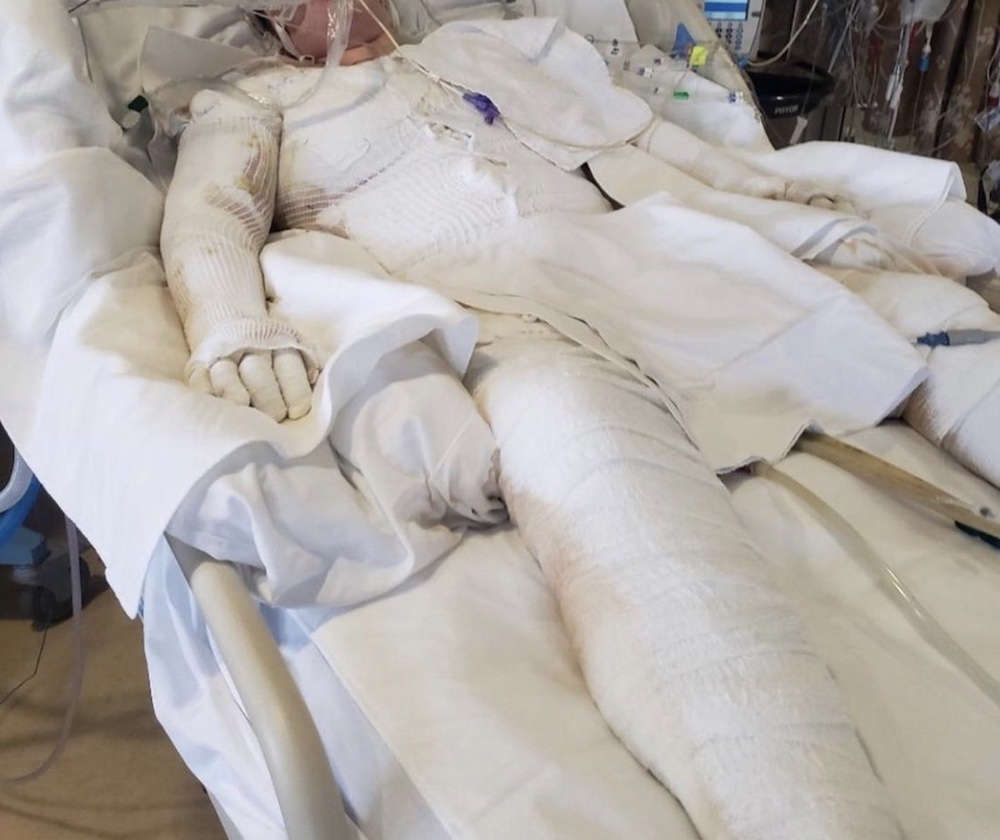 Laiha Slayton spent four months in Eastern Idaho Regional Medical Center.