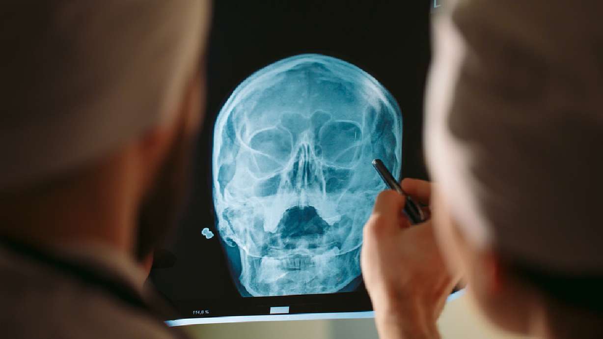 Bob Saget's death from a head injury gives us all something to think about