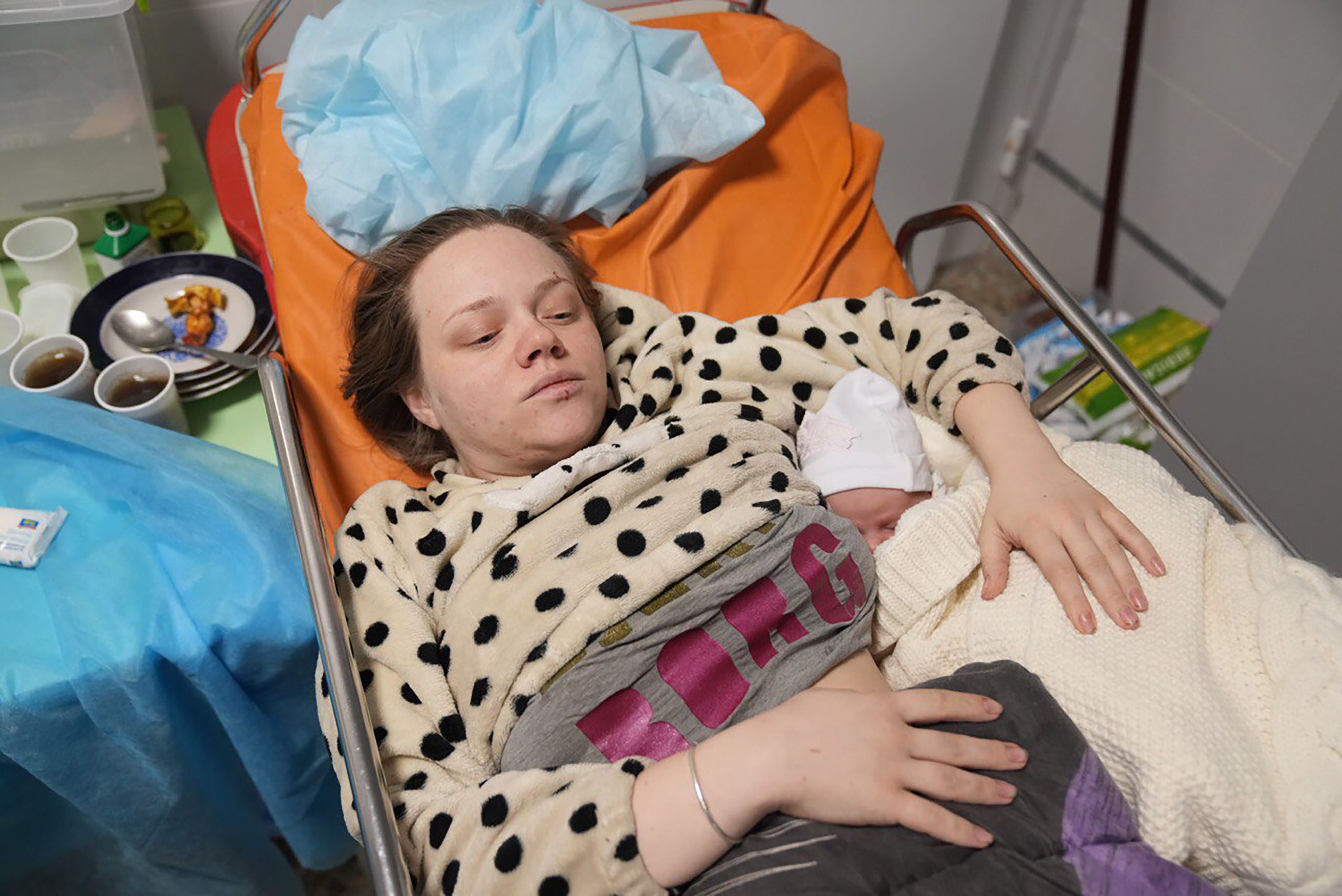Mariana Vishegirskaya lies in a hospital bed after giving birth to her daughter Veronika, in Mariupol, Ukraine, Friday. Vishegirskaya survived the Russian airstrike on a children’s and maternity hospital in Mariupol last Wednesday.