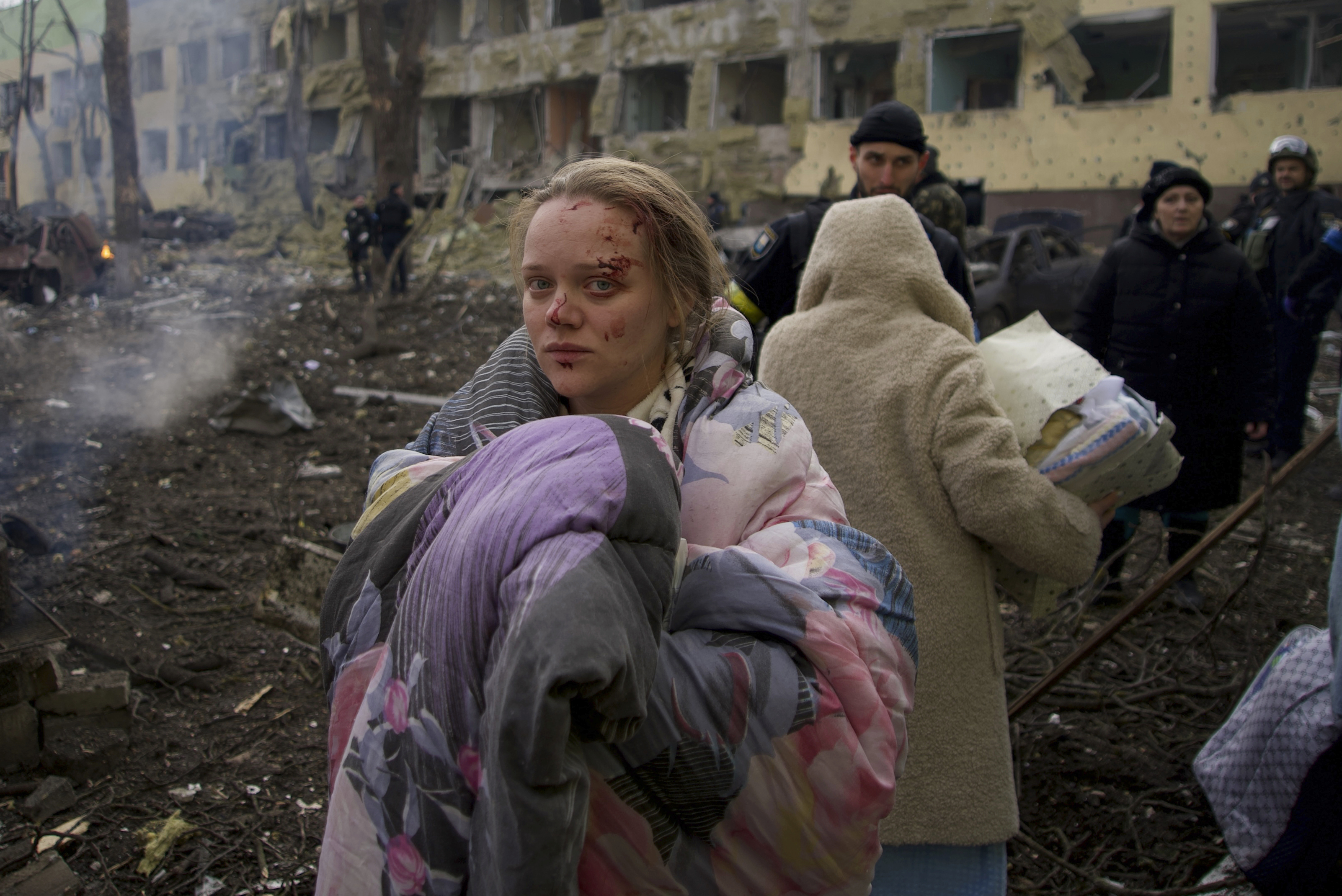 Mariana Vishegirskaya stands outside a maternity hospital that was damaged by shelling in Mariupol, Ukraine, Wednesday. Vishegirskaya survived the shelling and later gave birth to a girl in another hospital in Mariupol.