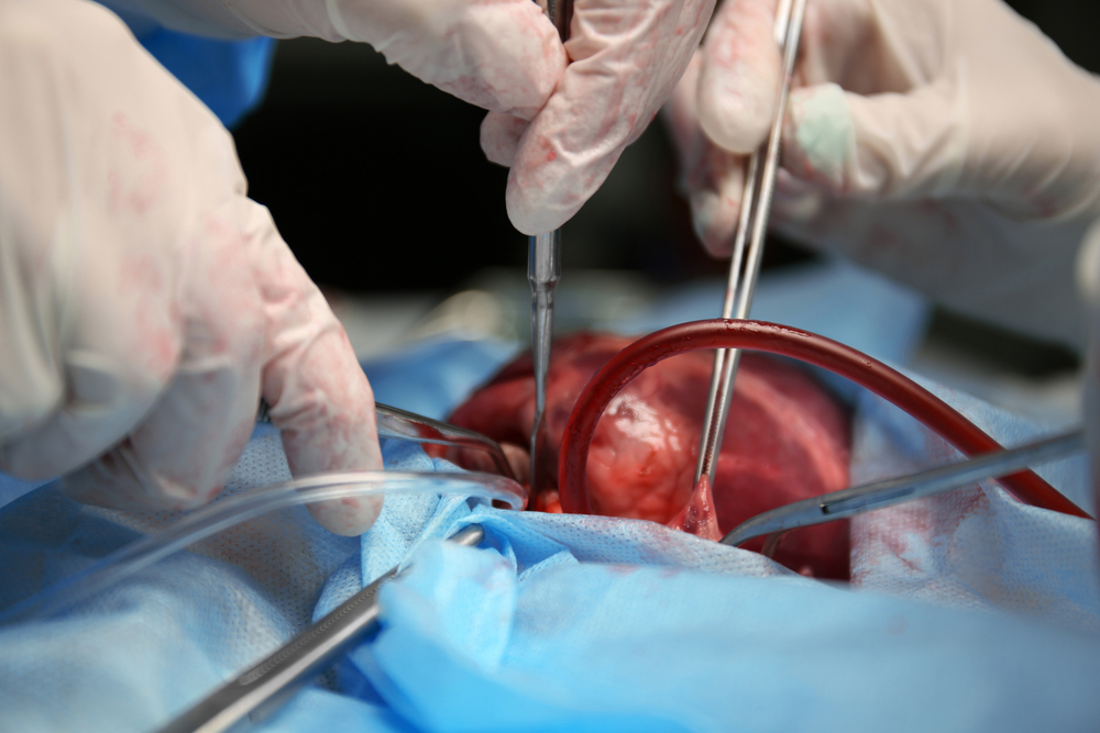 Breathing new life into the University of Utah Health's Transplantation Program