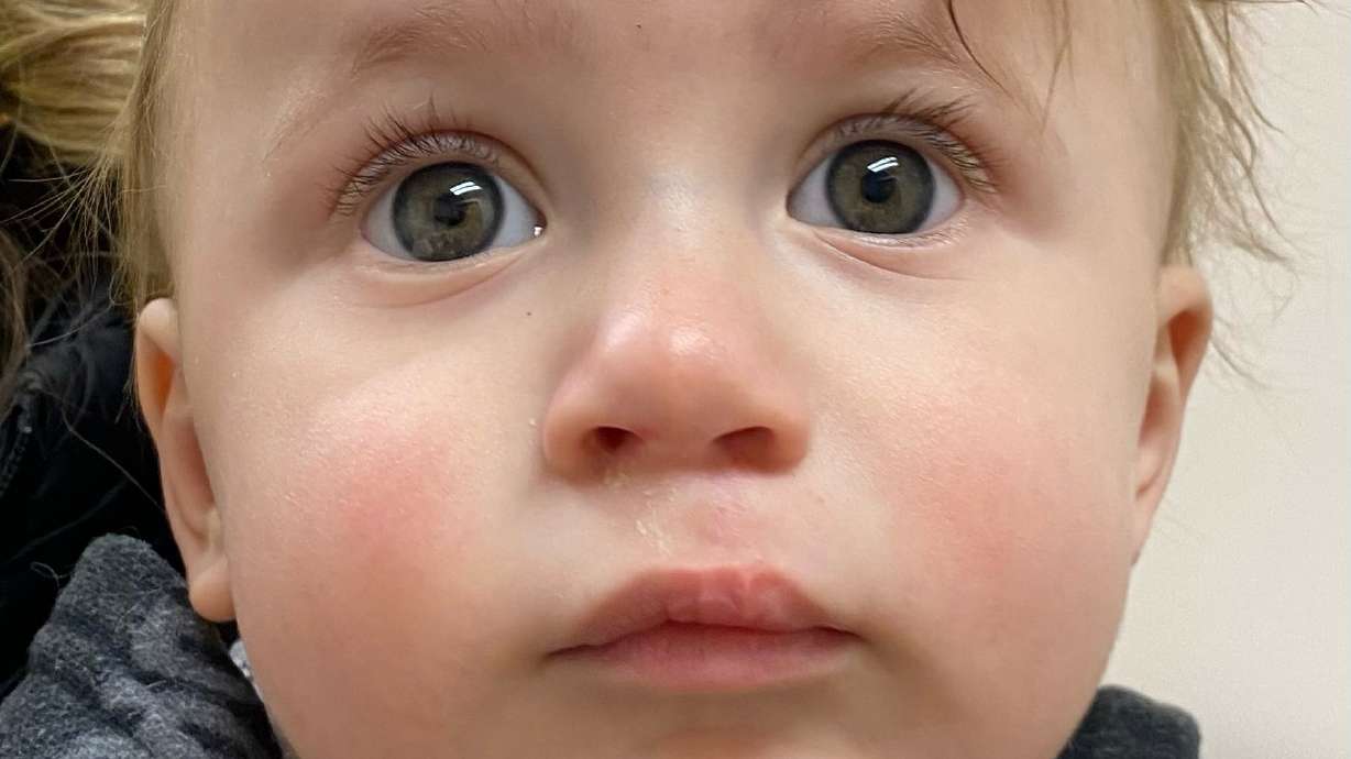 It takes a great medical team to navigate the cleft journey