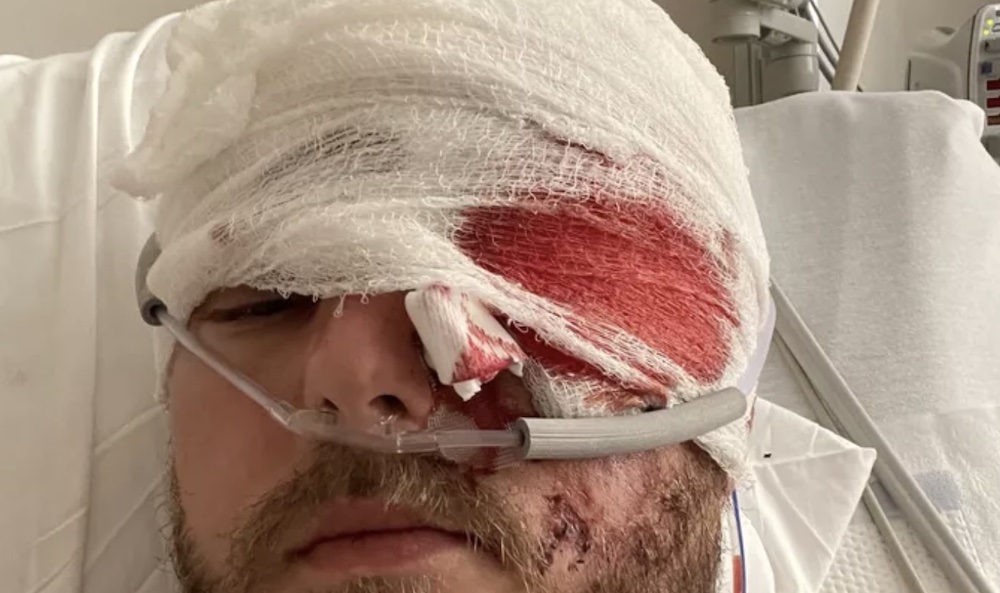 'He's so lucky to be alive': Newlywed father recovering after motorcycle crash