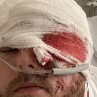 'He's so lucky to be alive': Newlywed father recovering after motorcycle crash