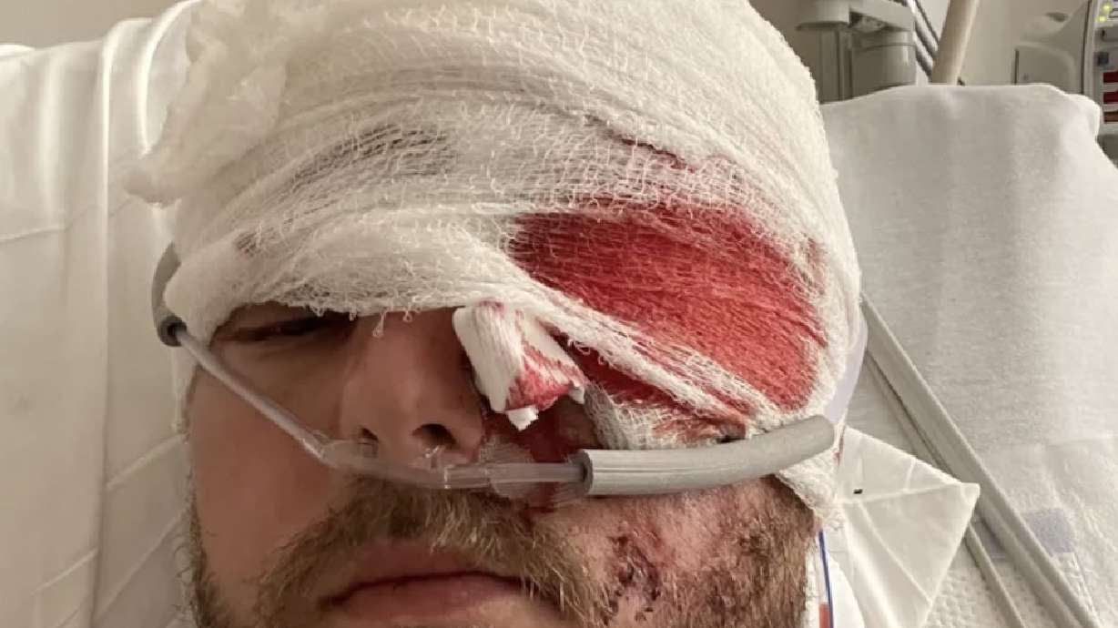 Brian Pinell, a newlywed father who recently welcomed his first child, is lucky to be alive after seriously hurting himself in a motorcycle crash.