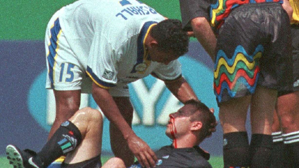 FILE - Miami Fusion's Tyrone Marshall (15) assists Kansas City Wizards' Scott Vermillion after the two collided while going up for a header in the first half of a soccer match Sunday, Aug. 29, 1999, in Kansas City, Mo. Researchers have diagnosed chronic traumatic encephalopathy in a Major League Soccer player for the first time, saying Tuesday, June 28, 2022, that former Sporting Kansas City defender Scott Vermillion suffered from the degenerative brain disease.