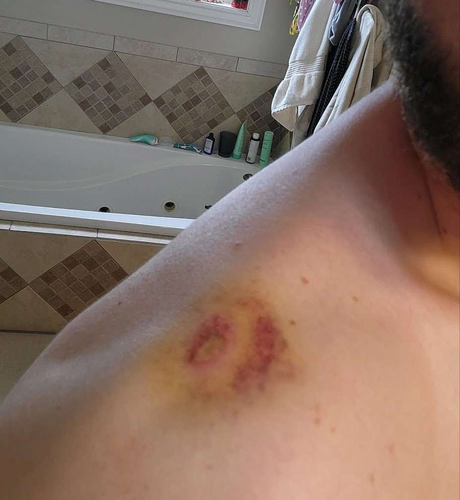 The Blattner family thought it was a rock that had launched through their vehicle's windshield, grazing two adults in the vehicle. They later learned it was a bullet. The incident left a bruise on Dallas Blattner.