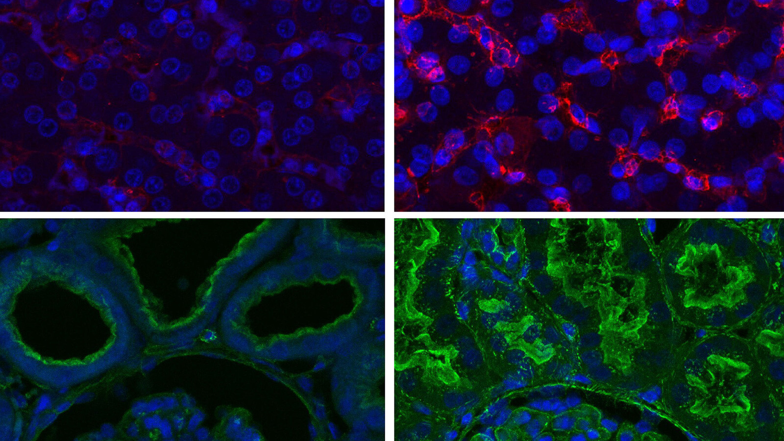 Researchers at Yale University say they have been able to restore blood circulation and other cellular functions in pigs a full hour after the animals' deaths, suggesting that cells don't die as quickly as scientists had assumed.