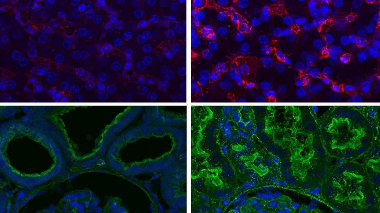 Researchers at Yale University say they have been able to restore blood circulation and other cellular functions in pigs a full hour after the animals' deaths, suggesting that cells don't die as quickly as scientists had assumed.
