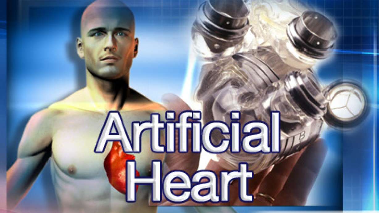 Artificial Heart Makes Its Return to Utah