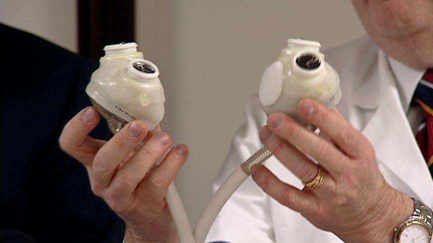 Artificial Heart Makes Its Return to Utah