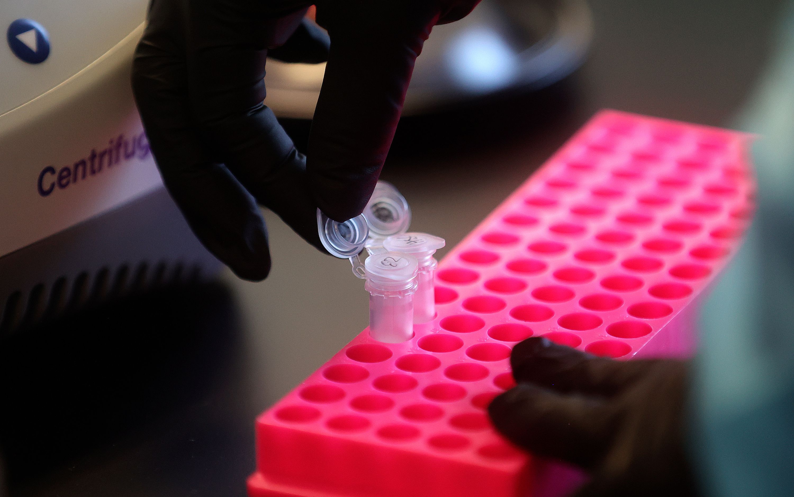 Annette Atkinson, Utah Public Health Laboratory infectious disease microbiologist, processes monkeypox test samples for DNA extraction at the Utah Public Health Laboratory in Taylorsville on Thursday. With 17 cases of monkeypox in youths up to 15 years old already reported nationwide, schools across the country are advised to be on the lookout for signs of the virus in students.