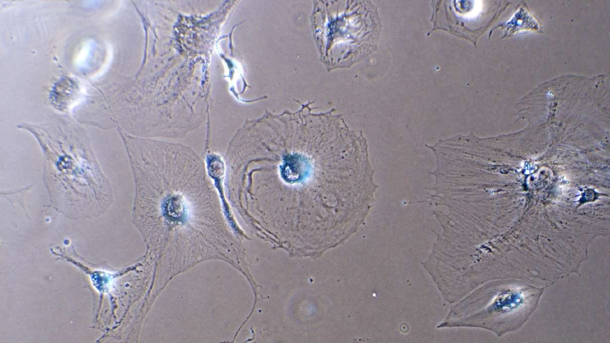 Zombie cells central to the quest for active, vital old age Zombie cells central to the quest for active, vital old age