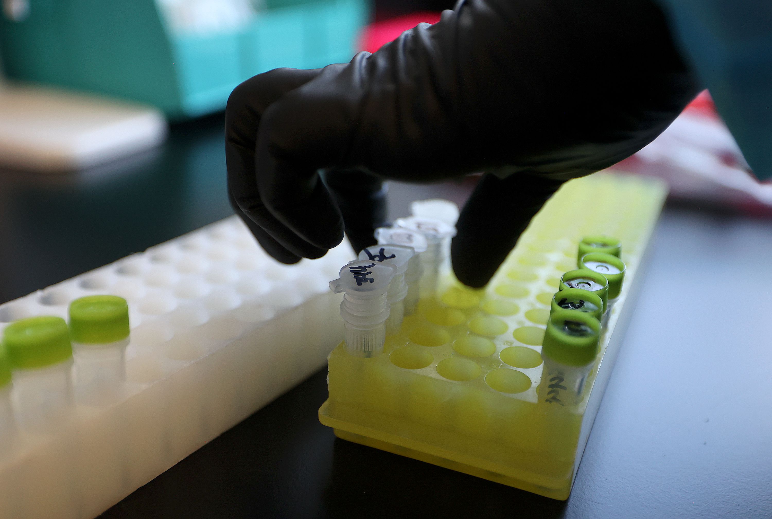 Annette Atkinson, Utah Public Health Laboratory infectious disease microbiologist, processes monkeypox test samples for DNA extraction at the Utah Public Health Laboratory in Taylorsville on Aug. 25. The second death of a person with monkeypox in the United States is under investigation in Los Angeles County to determine if the virus was a contributing cause of death.