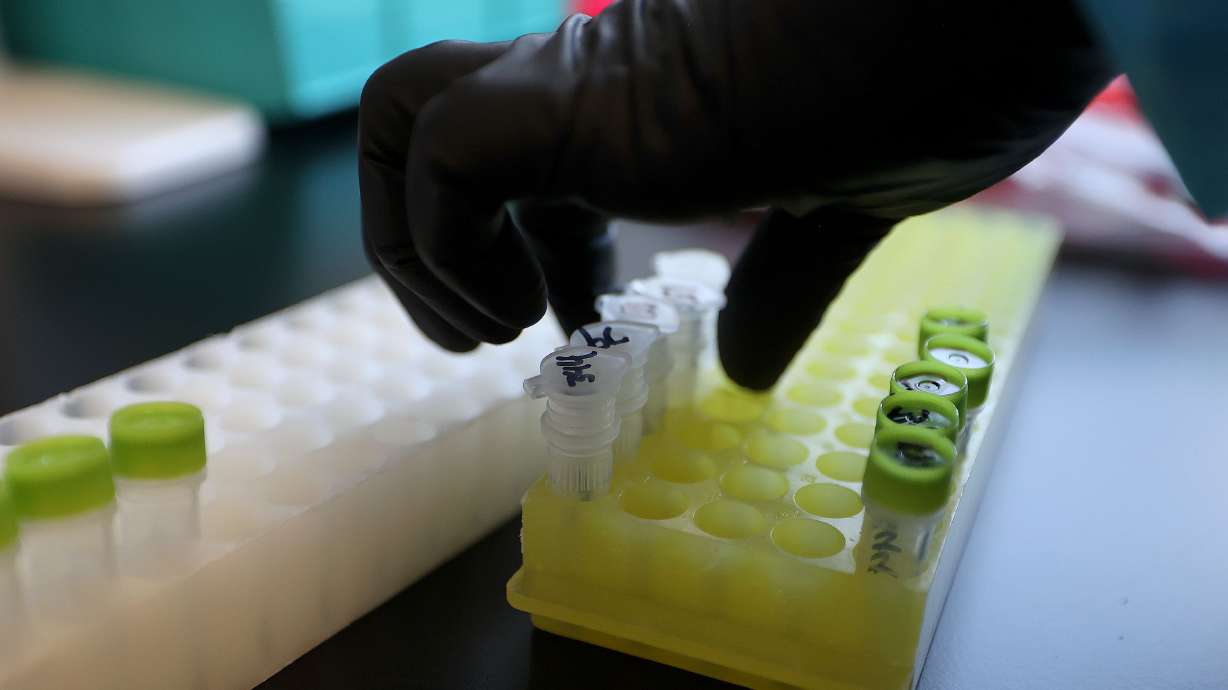 Annette Atkinson, Utah Public Health Laboratory infectious disease microbiologist, processes monkeypox test samples for DNA extraction at the Utah Public Health Laboratory in Taylorsville on Aug. 25. The second death of a person with monkeypox in the United States is under investigation in Los Angeles County to determine if the virus was a contributing cause of death.