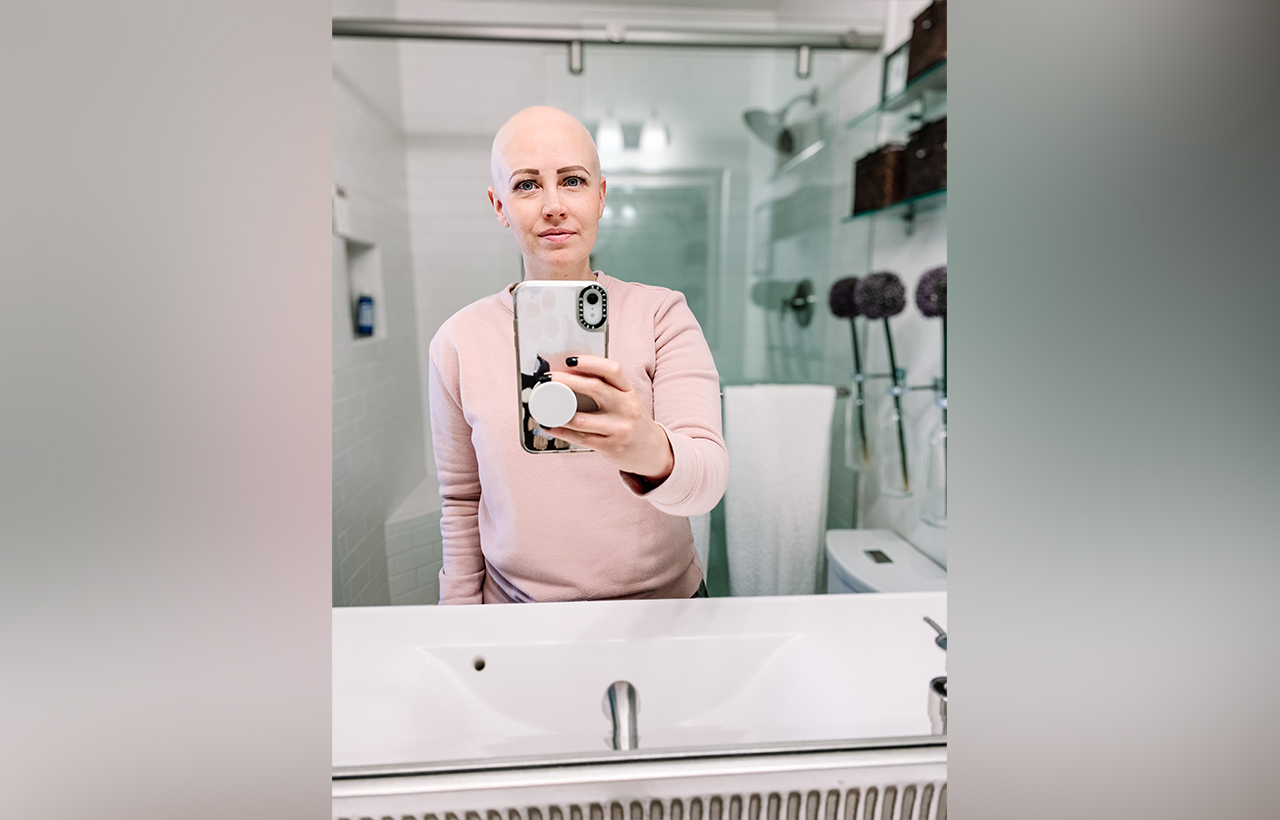 A photo of Elizabeth Dalton marking the end of her chemotherapy treatment, during which she lost all her hair.